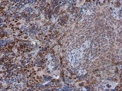 Immunohistochemistry-Paraffin: PDCD4 [p Ser457] Antibody [NBP3-13143] - PDCD4 (phospho Ser457) antibody detects PDCD4 (phospho Ser457) protein at nucleus in mouse spleen by immunohistochemical analysis. Sample: Paraffin-embedded mouse spleen. PDCD4 (phospho Ser457) antibody (NBP3-13143) diluted at 1:500. Antigen Retrieval: Citrate buffer, pH 6.0, 15 min